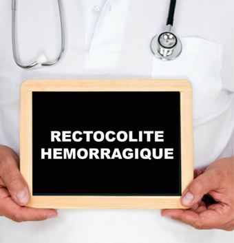 Rectocolite hemorragique