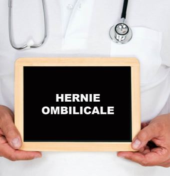 Hernie ombilicale
