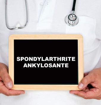 Spondylarthrite ankylosante